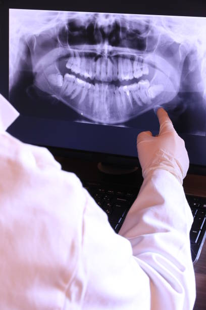 Best Emergency Tooth Extraction in Lakewood, WA