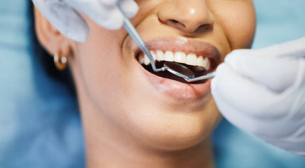 Best Emergency Treatment for Dental Infections or Abscesses in Lakewood, WA